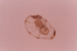 돌라올라리아(Doliolaria) 유생