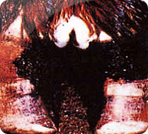 소의 지간에 형성된 수포 사진